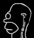 homer-xray